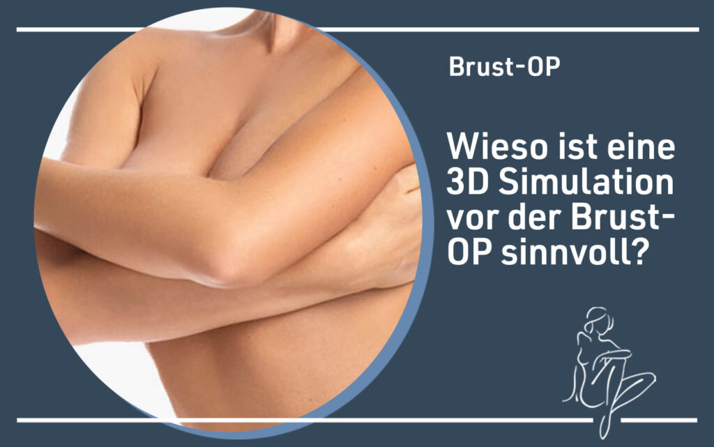 brust-op-3Dsimulation-vor-der-op-sinnvoll