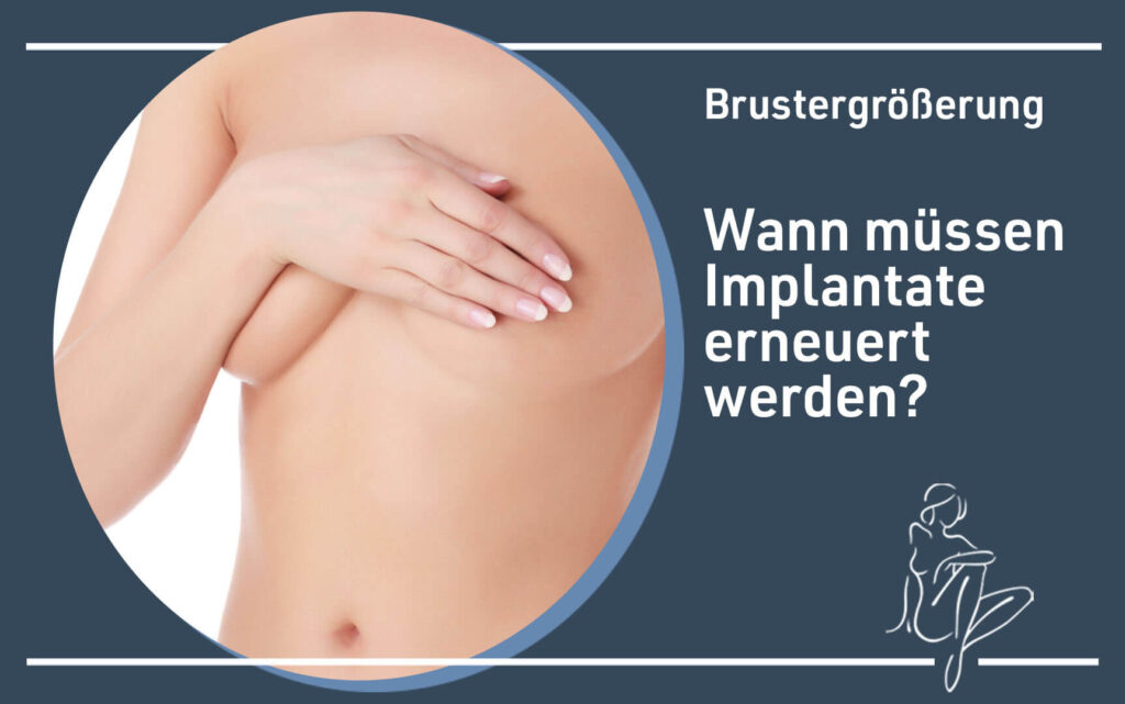 Brustvergrößerung Wann müssen Implantate erneuert werden Tipp